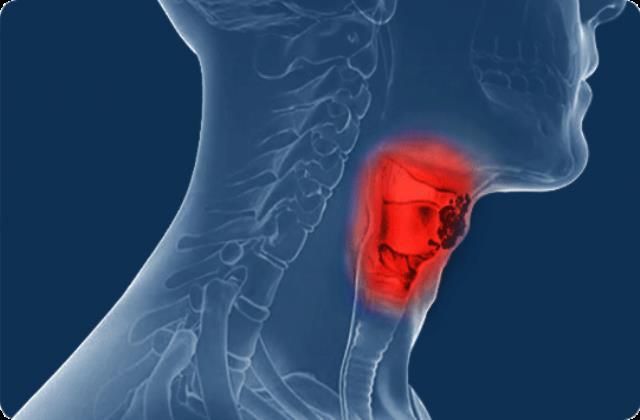 جراحی تومورها و تنگی نای